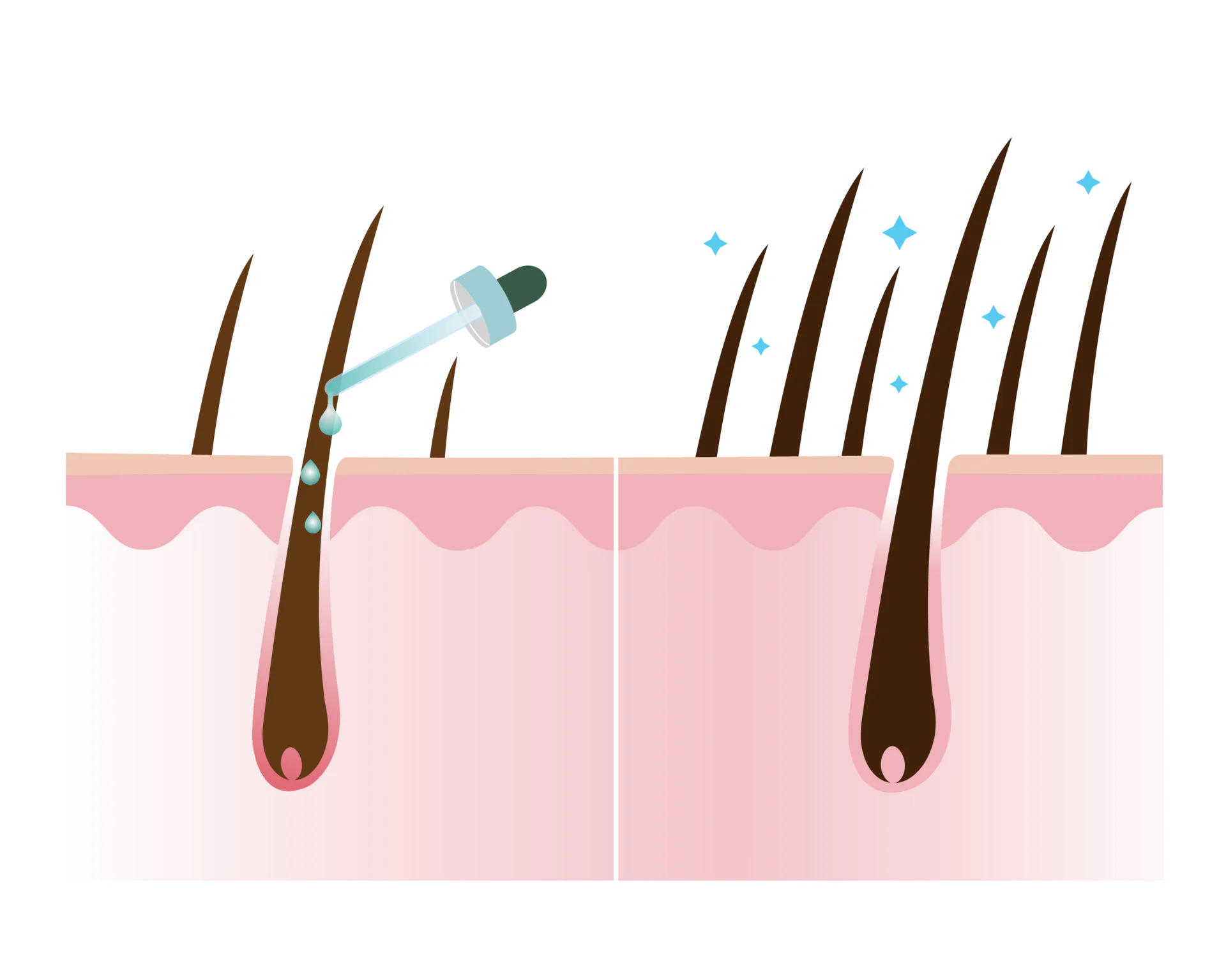 Hair Growth Supplements Category img2